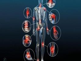 Viên uống bổ khớp tốt nhất được bác sĩ khuyên dùng