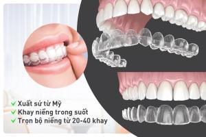 Nha khoa niềng răng invisalign trả góp uy tín nhất Hà Nội