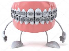 Điều cần biết trước khi niềng răng