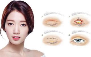 Địa chỉ nhấn mí đẹp nhất tại Hà Nội