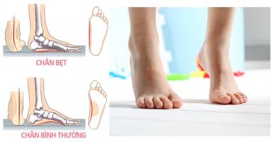 Địa chỉ khám chữa dị tật bàn chân bẹt ở trẻ tại Hà Nội