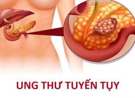 Điều cần biết nhất về căn bệnh ung thư tuyến tụy