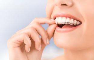 Địa chỉ niềng răng uy tín nhất quận 2, TP. HCM