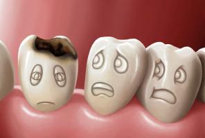 Bài thuốc điều trị sâu răng tại nhà hiệu quả nhất