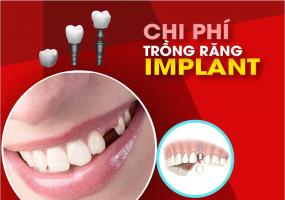 Giới thiệu về dịch vụ trồng răng Implant của Nha Khoa Đông Nam