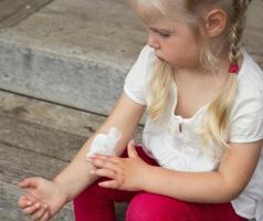 Bệnh da liễu thường gặp nhất ở trẻ nhỏ
