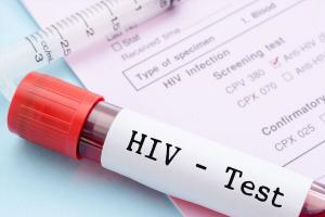 Bệnh viện xét nghiệm HIV uy tín nhất Hà Nội