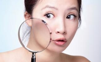 Bí quyết xóa sẹo thâm hữu ích nhất