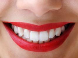 Bột tẩy trắng răng được ưa chuộng nhất hiện nay