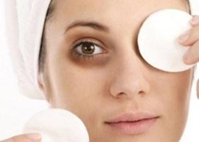 Cách trị thâm quầng mắt đơn giản, hiệu quả và tiết kiệm