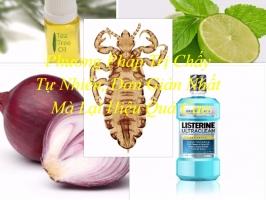 Cách trị chấy đơn giản mà hiệu quả nhất tại nhà