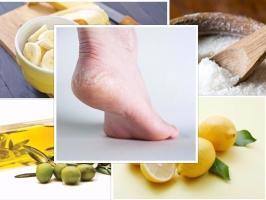 Cách trị nứt nẻ ở gót chân tự nhiên và an toàn nhất