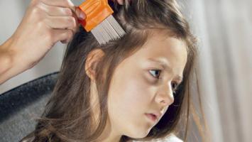 Dầu gội trị chấy hiệu quả, an toàn nhất hiện nay