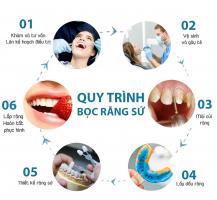 Địa chỉ bọc răng sứ thẩm mỹ tốt nhất tại quận Tây Hồ, Hà Nội