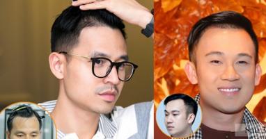 Địa chỉ cấy tóc uy tín nhất tại Hà Nội