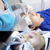 Địa chỉ điều trị mụn, nặn mụn tại Quận 9 và Thủ Đức được ưa chuộng nhất