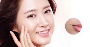 Địa chỉ điều trị tẩy nốt ruồi tại Hà Nội: uy tín & hiệu quả nhất