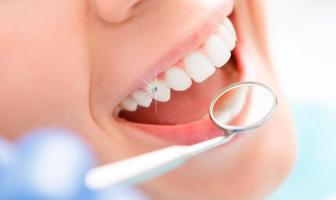 Địa chỉ đính đá răng đẹp và an toàn nhất tại Hà Nội