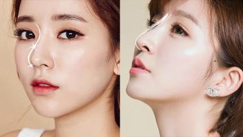 Địa chỉ nâng mũi đẹp và an toàn nhất Đà Nẵng