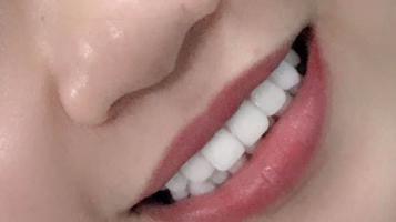 Địa chỉ nha khoa thẩm mỹ được lựa chọn nhiều nhất