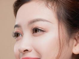 Địa chỉ nhấn mí, cắt mí đẹp và an toàn nhất quận 10, TP. HCM