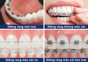 Địa chỉ niềng răng uy tín nhất Đà Lạt