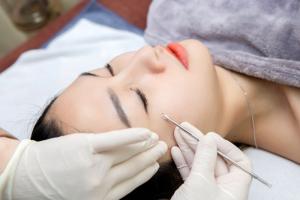 Địa chỉ trị mụn và sẹo uy tín nhất ở TP. Biên Hòa, Đồng Nai