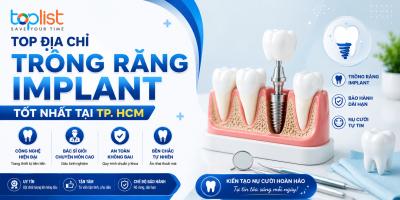 Địa chỉ trồng răng Implant tốt nhất tại TP. HCM