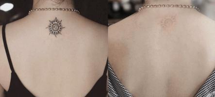 Địa chỉ xóa xăm uy tín nhất Cà Mau