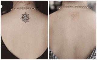 Địa chỉ xóa xăm uy tín nhất Cần Thơ