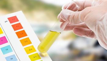 Lưu ý quan trọng nhất khi thử nước tiểu