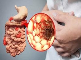 Lưu ý quan trọng nhất về bệnh Crohn