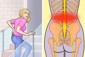 Nguyên nhân gây đau thắt lưng và cách phòng tránh
