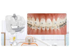 Nha khoa niềng răng mắc cài sứ dây trong uy tín nhất tỉnh Hưng Yên