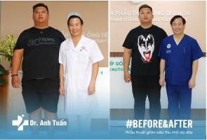 Bác sĩ hàng đầu Việt Nam điều trị thừa cân, béo phì