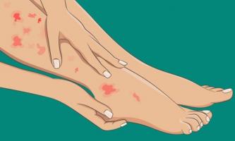 Dấu hiệu ở chân có thể cảnh báo về tình hình sức khỏe của bạn