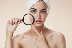 Sai lầm khi chăm sóc da có thể khiến da bạn nổi mụn