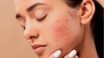 Sai lầm phổ biến khi chăm sóc da có thể gây hại cho da mặt của bạn