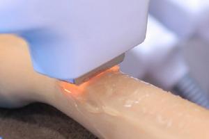 Spa/TMV triệt lông tại Nghệ An: uy tín & hiệu quả nhất