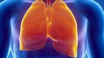 Thực phẩm chức năng giải độc phổi, bổ phổi tốt nhất hiện nay