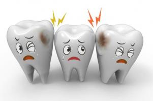 Kem đánh răng đặc trị ngừa sâu răng hiệu quả nhất hiện nay