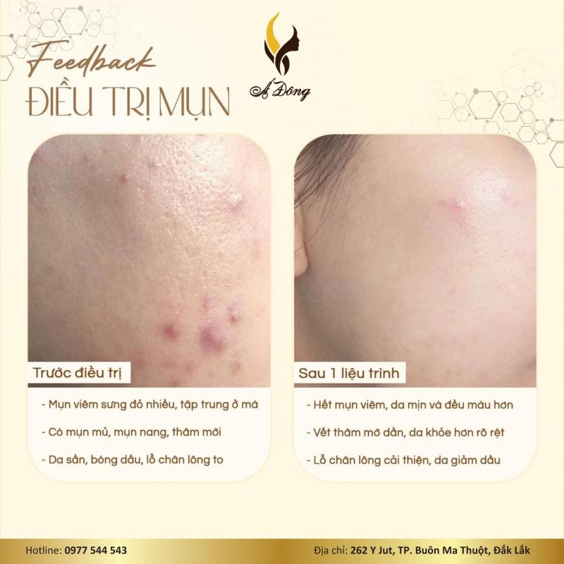 Á Đông Clinic & Spa