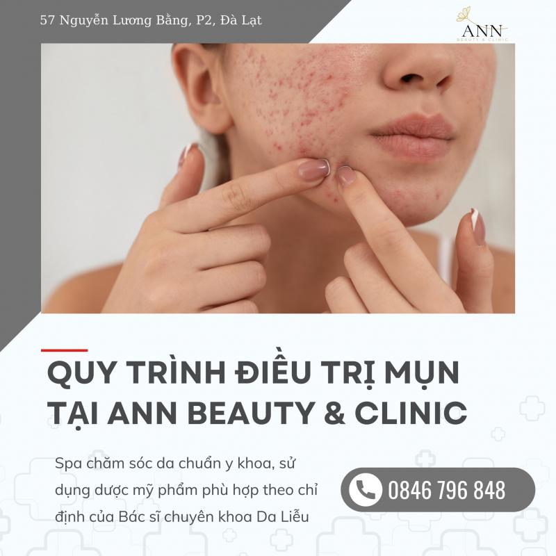 ANN Beauty & Clinic - Spa Trị Mụn Hiệu Quả, Chuẩn Y Khoa Tại Đà Lạt