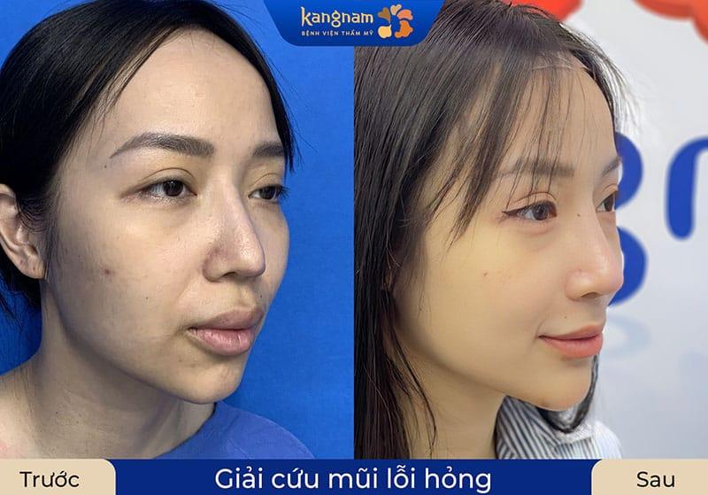 Bệnh viện thẩm mỹ Kangnam