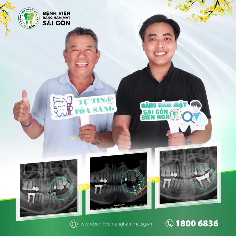 Bệnh Viện Răng Hàm Mặt Sài Gòn