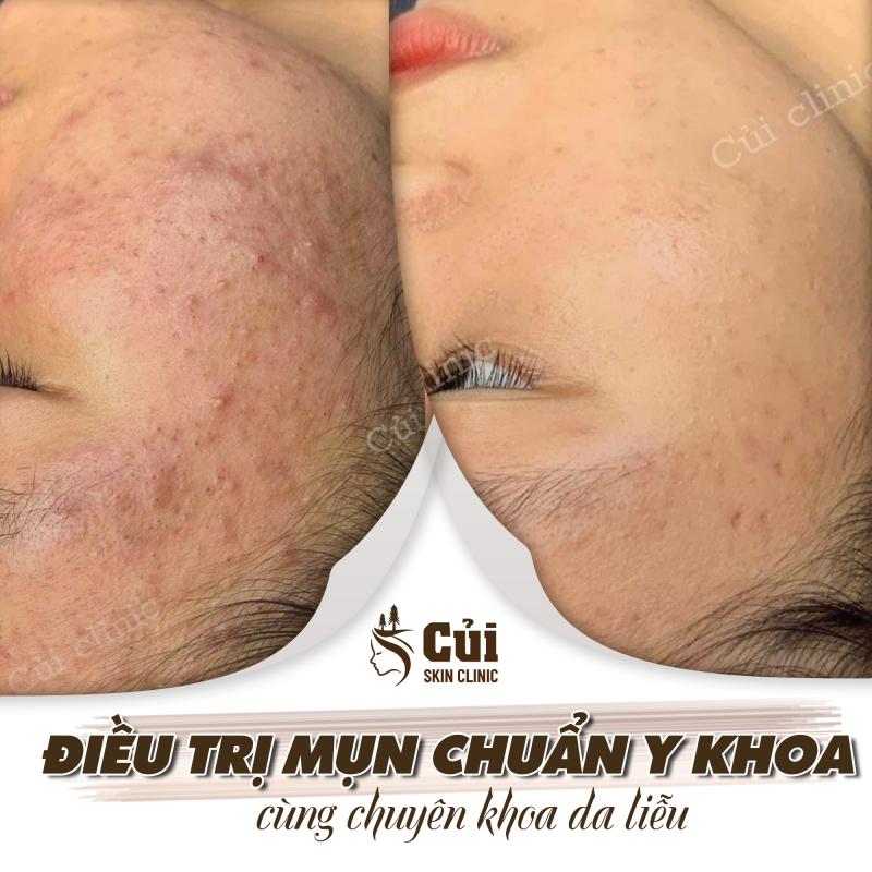 Củi Clinic - Điều Trị Da Đà Lạt