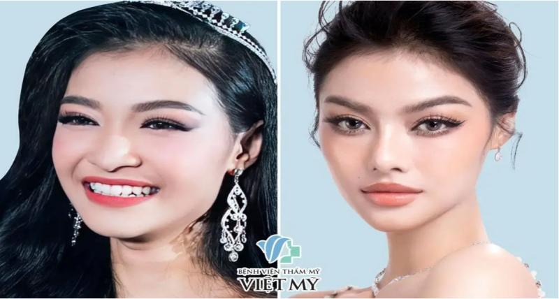 Bệnh viện thẩm mỹ Việt Mỹ