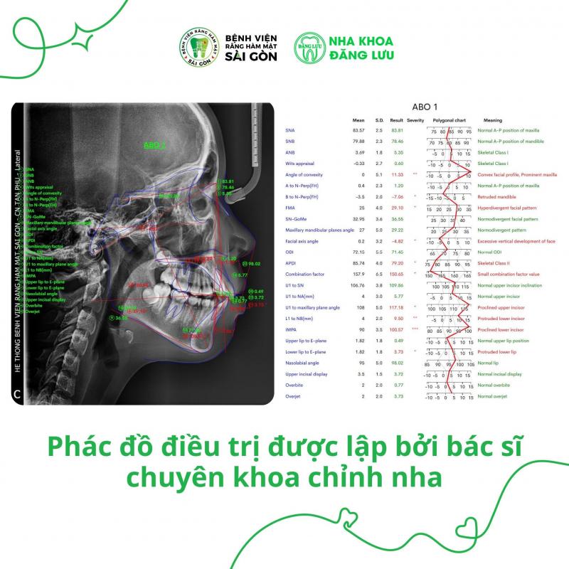 Phác đồ điều trị được lập bởi bác sĩ chuyên khoa chỉnh nha