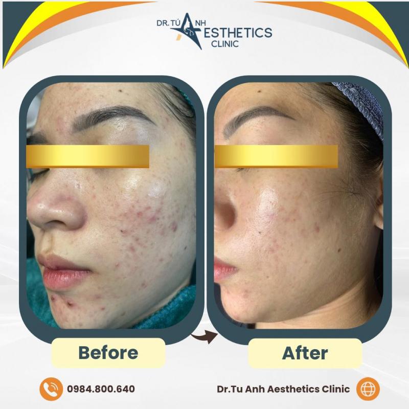 Dr.Tú Anh Aesthetics Clinic