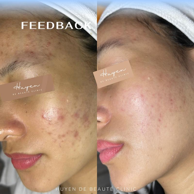 Huyen de Beauté Clinic